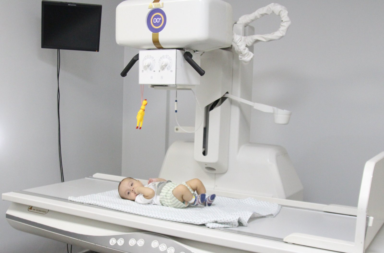 Hecad ultrapassa 1 milhão de exames realizados e reforça assistência diagnóstica pediátrica em Goiás